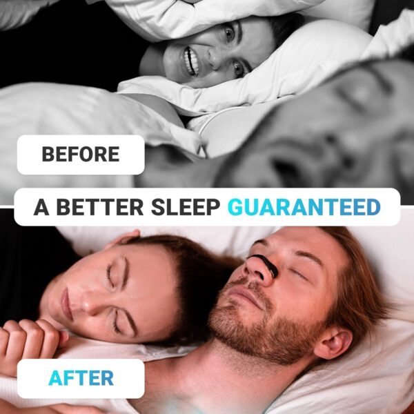 ⁦NOSE STARHTER KIT - لاصقات مغناطيسية للأنف⁩ - الصورة ⁦5⁩